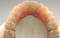Photo: prothèses plastiques