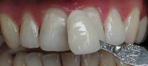 Photo: Correspondance des couleurs