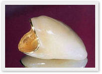 Photo: couronne sur un cadre doré