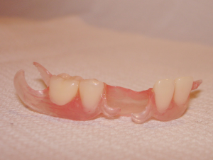Photo: prothèse avec fermoirs