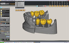 Photo: technologie CAD / CAM