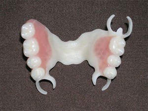 Photo: Prothèse en polyuréthane avec fermoirs