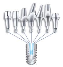 Photo: implants Ankylos