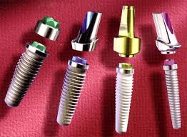 Photo: Implants dentaires