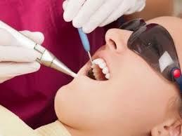 Photo: implantation laser