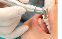Photo: Effectuer un brossage des dents professionnel
