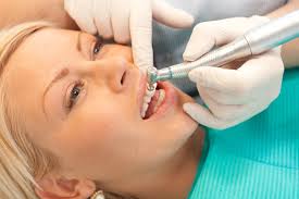 Photo: Assainissement oral avant la chirurgie