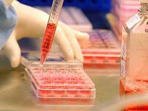 Photo: Surveillance de la glycémie en laboratoire
