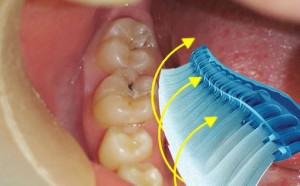 Photo: Soins dentaires avec une brosse