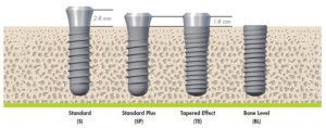 Photo: Types d'implants Straumann