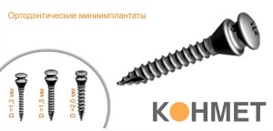 Photo: mini-implants Conmet