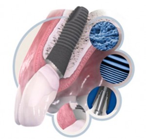 Foto: implants dentals astra tech