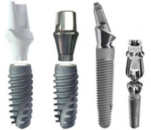 Photo: Implants