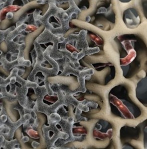 Photo: Surface de l'implant poreux