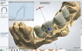Photo: Technologie CAD / CAM