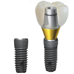 Photo: Implants Implantium