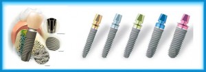 Photo: Variétés d'implants Xive