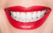 Photo: dents Cermet