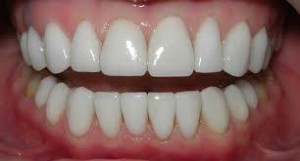 Photo: dentition parfaitement uniforme