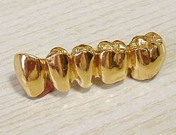 Photo: Denture
