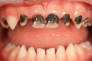 Photo: caries de dents de feuillus