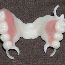 Photo: prothèse Quadrotti