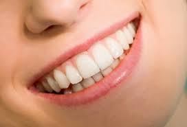 Photo: couronnes sur les dents de devant