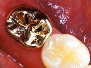 Photo: Couronne en métal