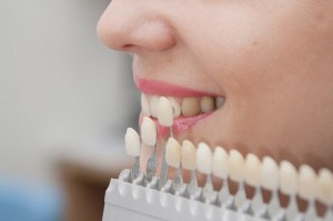 Photo: échelle pour sélectionner la couleur des dents