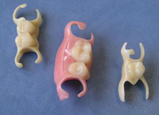 Photo: Denture Butterfly