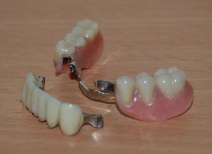 Photo: prothèse à fermoir avec serrures