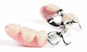 Photo: prothèse à fermoir avec fixation par fermoir