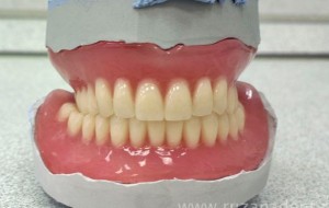 Photo: Fabrication d'une prothèse de plaque dans un laboratoire