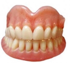 Photo: prothèse laminaire entièrement amovible sur la mâchoire supérieure et inférieure