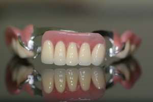 Photo: Prothèse à fermoir pour la mâchoire supérieure