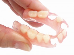 Photo: Prothèse partielle en nylon sur la mâchoire inférieure