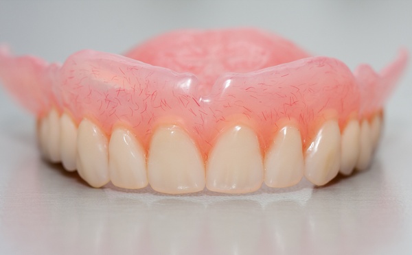 Photo: prothèse complète en silicone