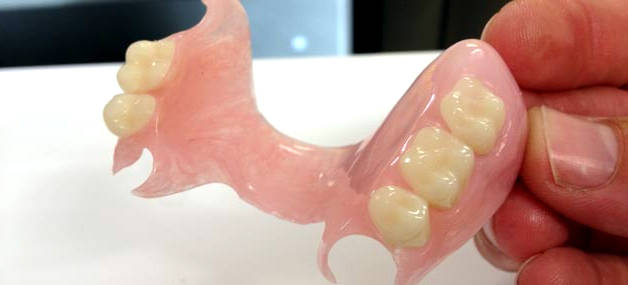 Photo: prothèse partielle en silicone