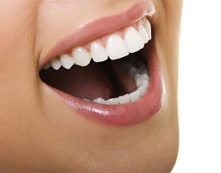 Photo: prothèses en silicone sur la mâchoire supérieure
