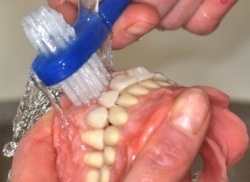 Photo: brossage d'une prothèse sous l'eau courante