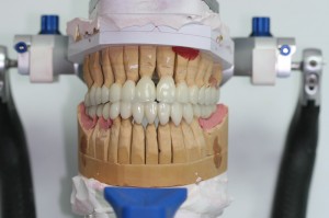 Fotó: Articulator Modeling