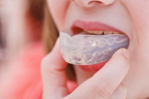 Photo: Correction des morsures par les formateurs