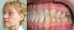 Foto: signos faciales e intraorales de anomalía