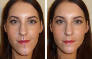 Photo: Asymmetry of the face