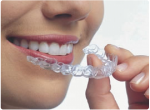 Photo: Correction d'une morsure par la bouche