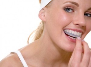 Photo: Blanchiment des dents avec un protège-dents