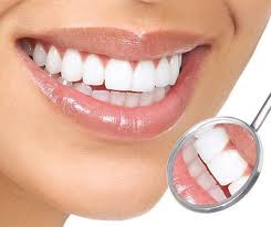 Foto: denti dopo lo sbiancamento