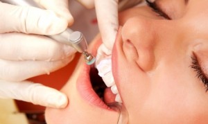 Foto: Blanquejament de dents a l’odontòleg